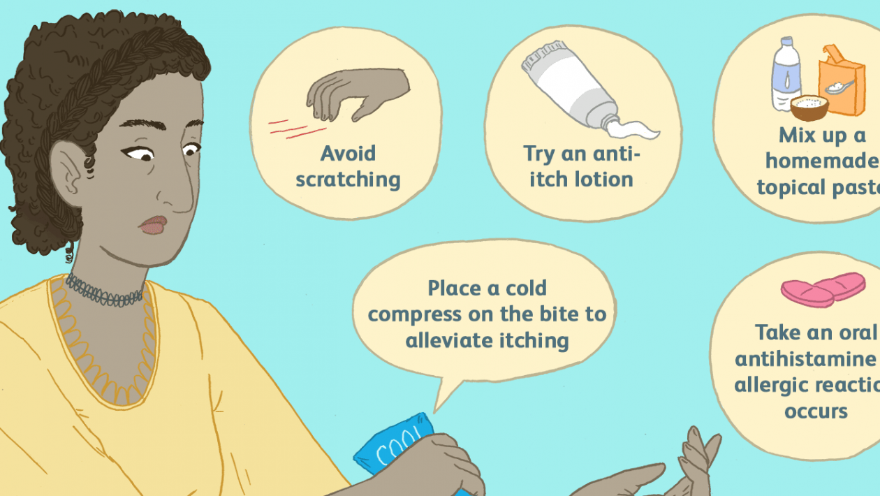 how to stop mosquito bites from itching