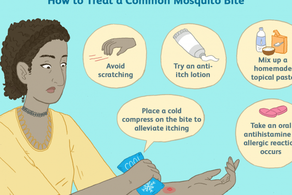 how to stop mosquito bites from itching