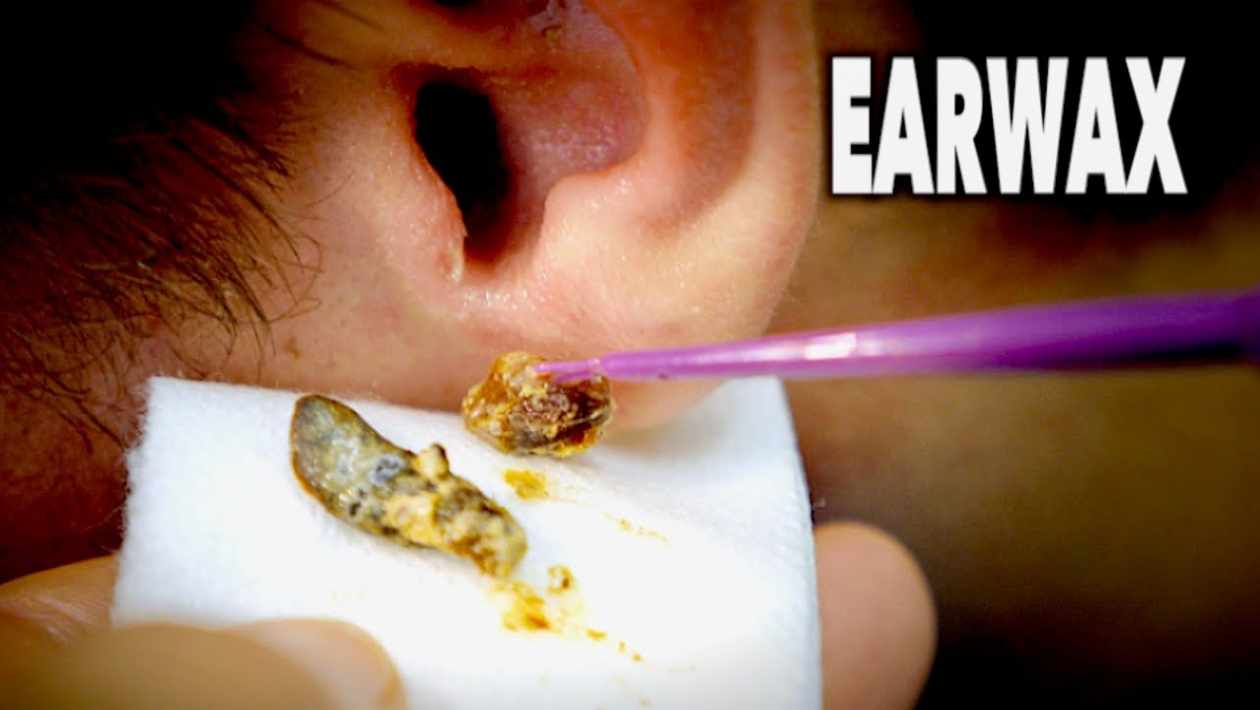 how to get rid of earwax