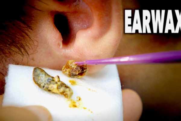 how to get rid of earwax