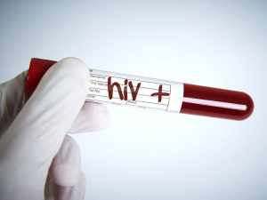 Importance of detecting HIV early