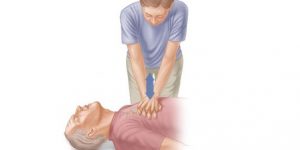 CPR on an Adult